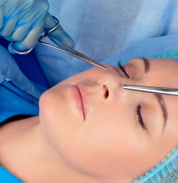 Can You Customize Rhinoplasty Fully?