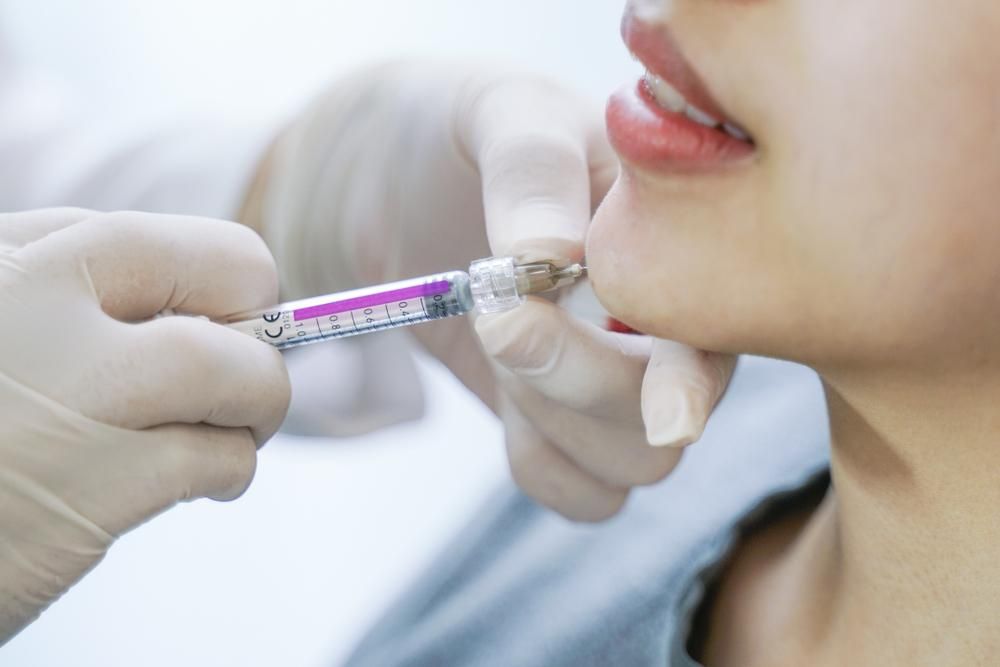 Do You Need a Consultation for Jawline Fillers?