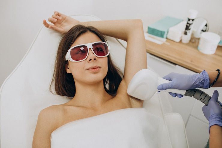 What Is Laser Hair Removal Treatment?