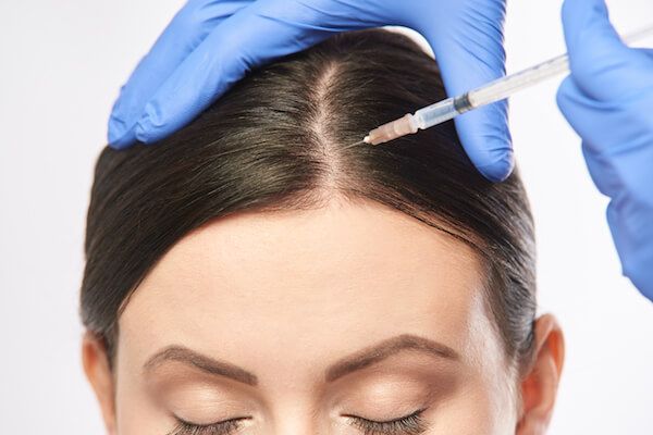 Can PRP Treat Genetic Hair Loss?
