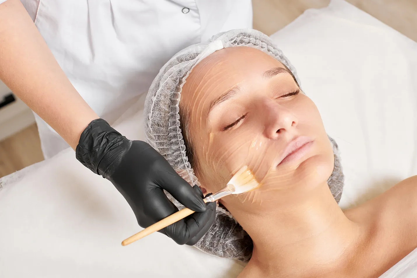 Can Peels Improve Uneven Skin Tone Fast?
