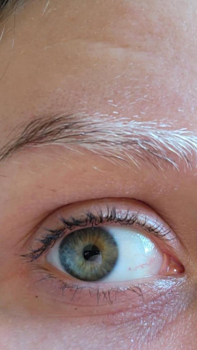 Can White Hair Be Removed From Eyebrows Safely?