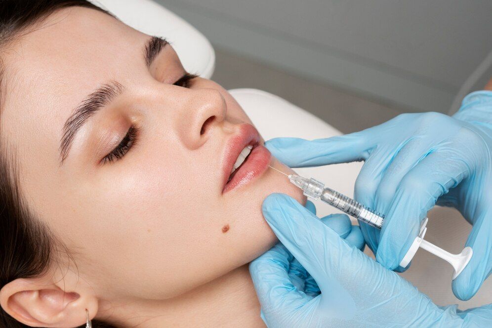 What Lip Filler Looks Best on Small Lips?